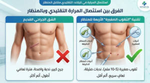 تقنية استئصال المرارة بالمنظار عبر ثقوب صغيرة في تايلاند